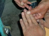 酷刑演示：将大头针往法轮功学员指甲缝里扎。