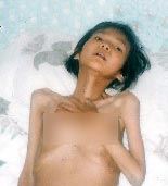 '残疾女子杨苏红被迫害后皮包骨头离世'